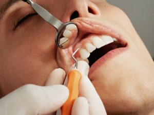 Diabetes Affect Oral Health